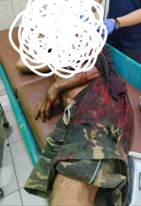 Pembacokan di Kloneng Jadi Pemantik Ketegangan, Polisi Siaga Antisipasi Bentrokan dan Buru Pelaku 